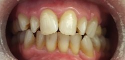 Natick Family Dental Natick Family Dental